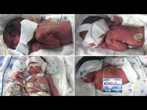 Mother Gives Birth To Two Sets Of Identical Twins